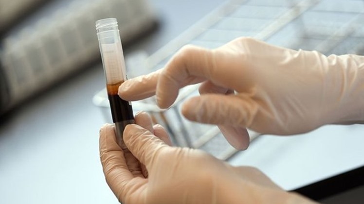 Egypt's Health min. heads for Germany to discuss boosting enhancing in health field