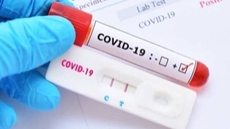 Egypt first country in Africa, Middle East to provide COVID-19 pill molnupiravir: Min.